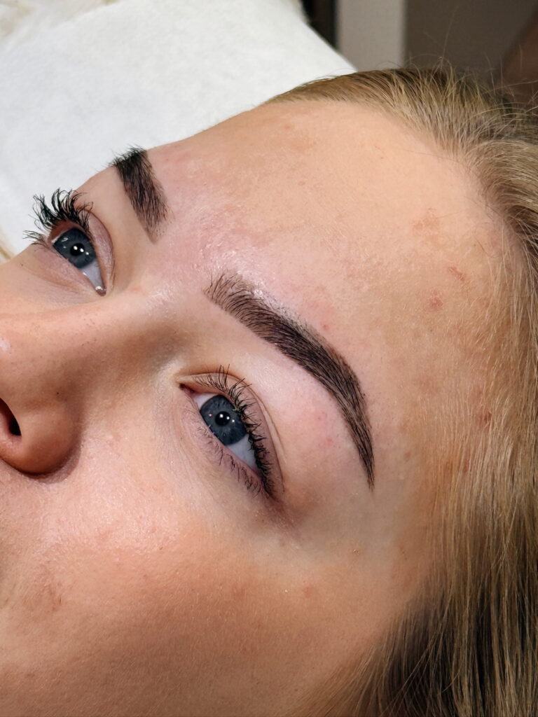 Browbar — pilt 2